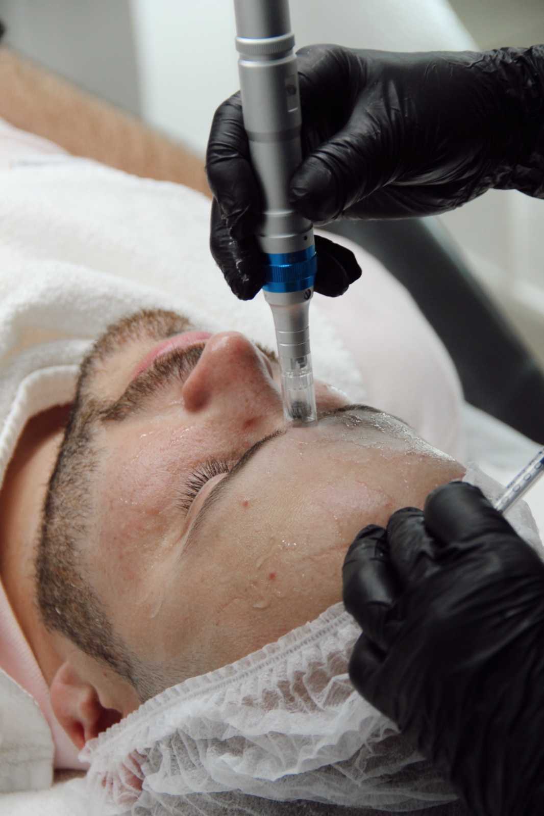 Tratamiento antiage con hidrodermabrasión para rejuvenecimiento facial en Glenz Studio